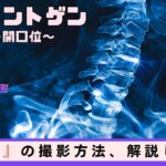 【放射線技師】頸椎レントゲンの撮影方法を現役の放射線技師が解説！～頸椎(開口位)～