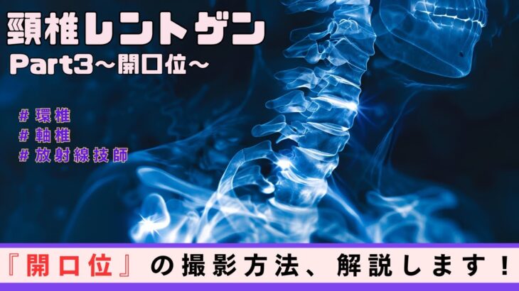 【放射線技師】頸椎レントゲンの撮影方法を現役の放射線技師が解説！～頸椎(開口位)～